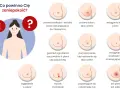 Guzek na piersi? Nie panikuj! Szybka ścieżka do diagnozy.