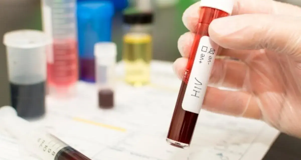 Leczenie HIV w Polsce: Bezpłatne ARV dla każdego? Sprawdź zasady!