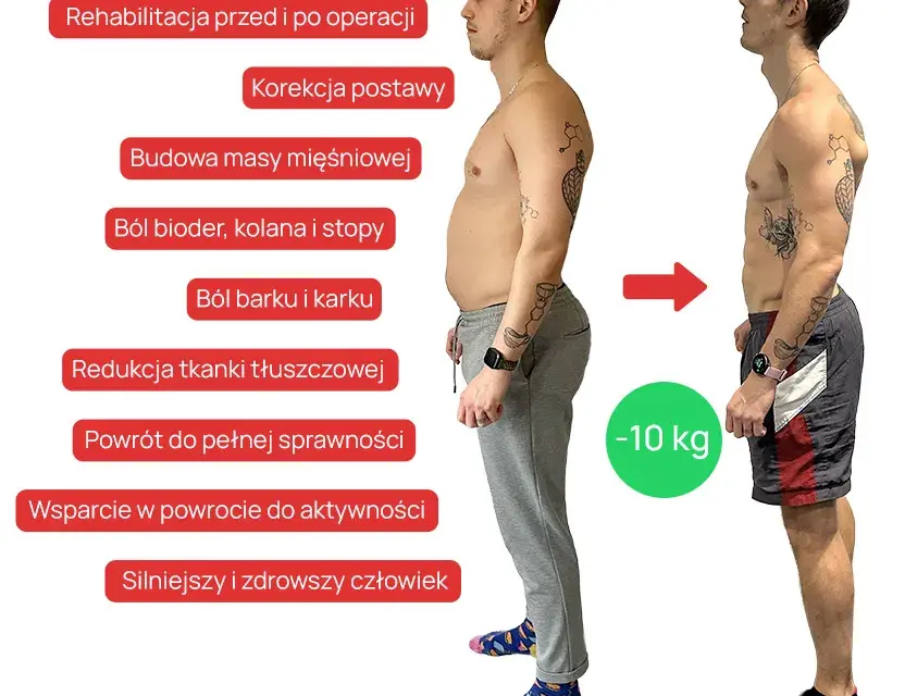 Kiedy rehabilitacja przynosi efekty? Realne ramy czasowe