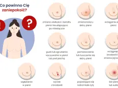 Guzek na piersi? Nie panikuj! Szybka ścieżka do diagnozy.
