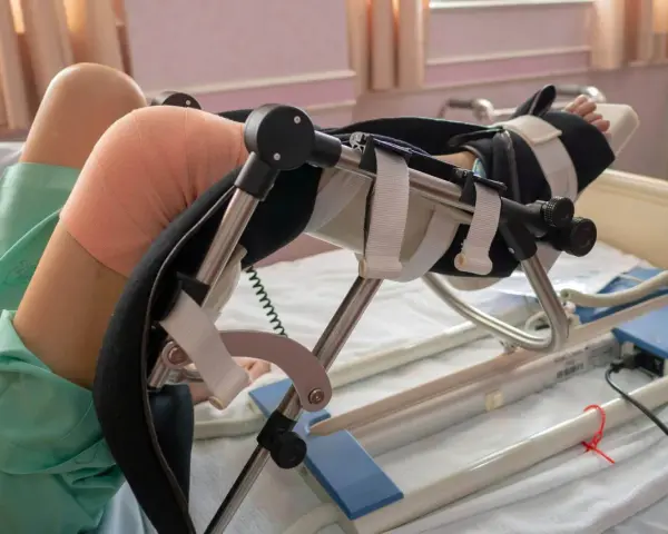 Rehabilitacja po endoprotezie kolana: Jak długo? Etapy i porady