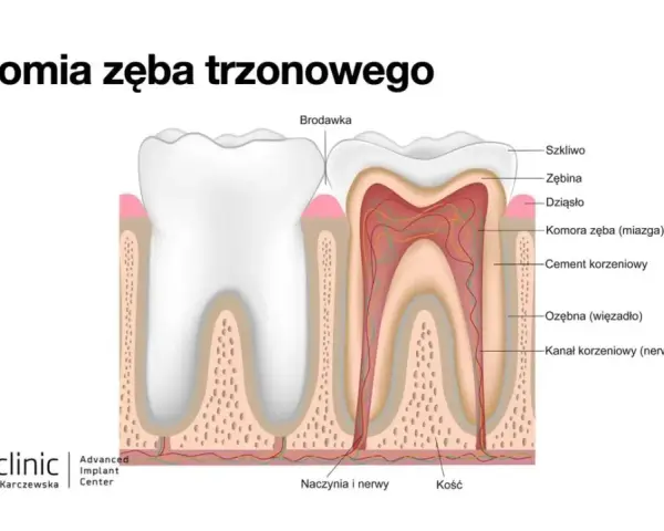 Ból po leczeniu kanałowym: normalne czy niepokojące? Poradnik