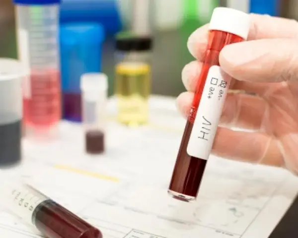 Leczenie HIV w Polsce: Bezpłatne ARV dla każdego? Sprawdź zasady!