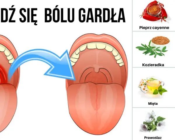 Ciepłe czy zimne na ból gardła? Wybierz mądrze i poczuj ulgę!
