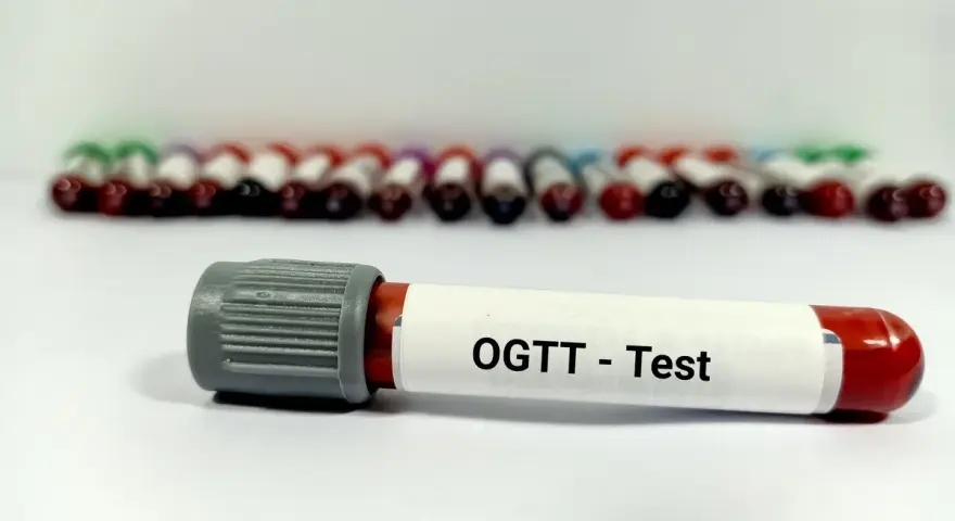 Probówka z oznaczeniem "OGTT - Test" na tle wielu innych próbek krwi. To kluczowy element w diagnostyce cukrzycy, czyli test obciążenia glukozą.