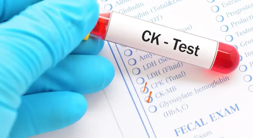 Badanie CK-MB, kluczowe dla diagnostyki chorób serca, może być pomocne w ocenie ryzyka związanego z nowotworem.