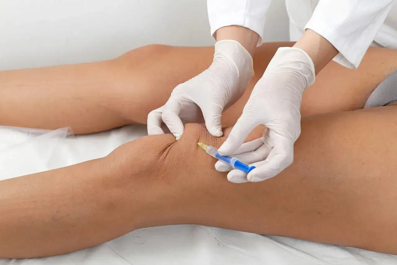 Zastrzyki kwas hialuronowy kolano vs blokada sterydowa