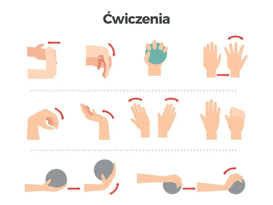 harmonogram rehabilitacji cieśni nadgarstka